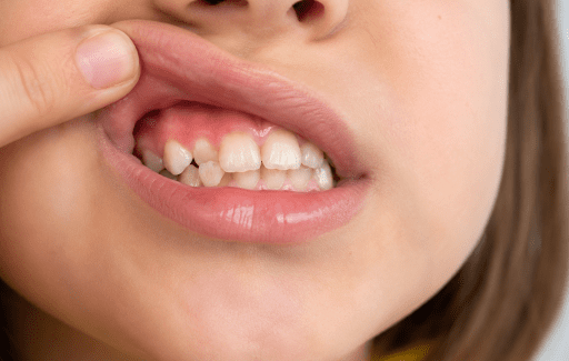 Enfant montrant une dent de lait